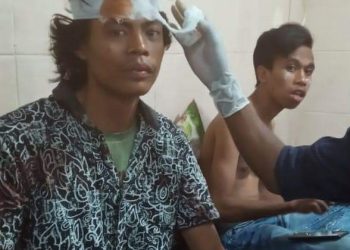 Anggota alami luka robek, HMI Dompu kutuk tindakan represif Polisi