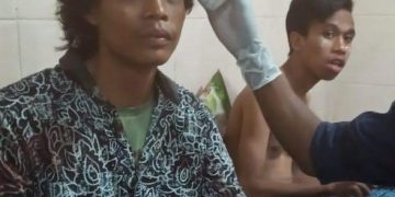 Anggota alami luka robek, HMI Dompu kutuk tindakan represif Polisi